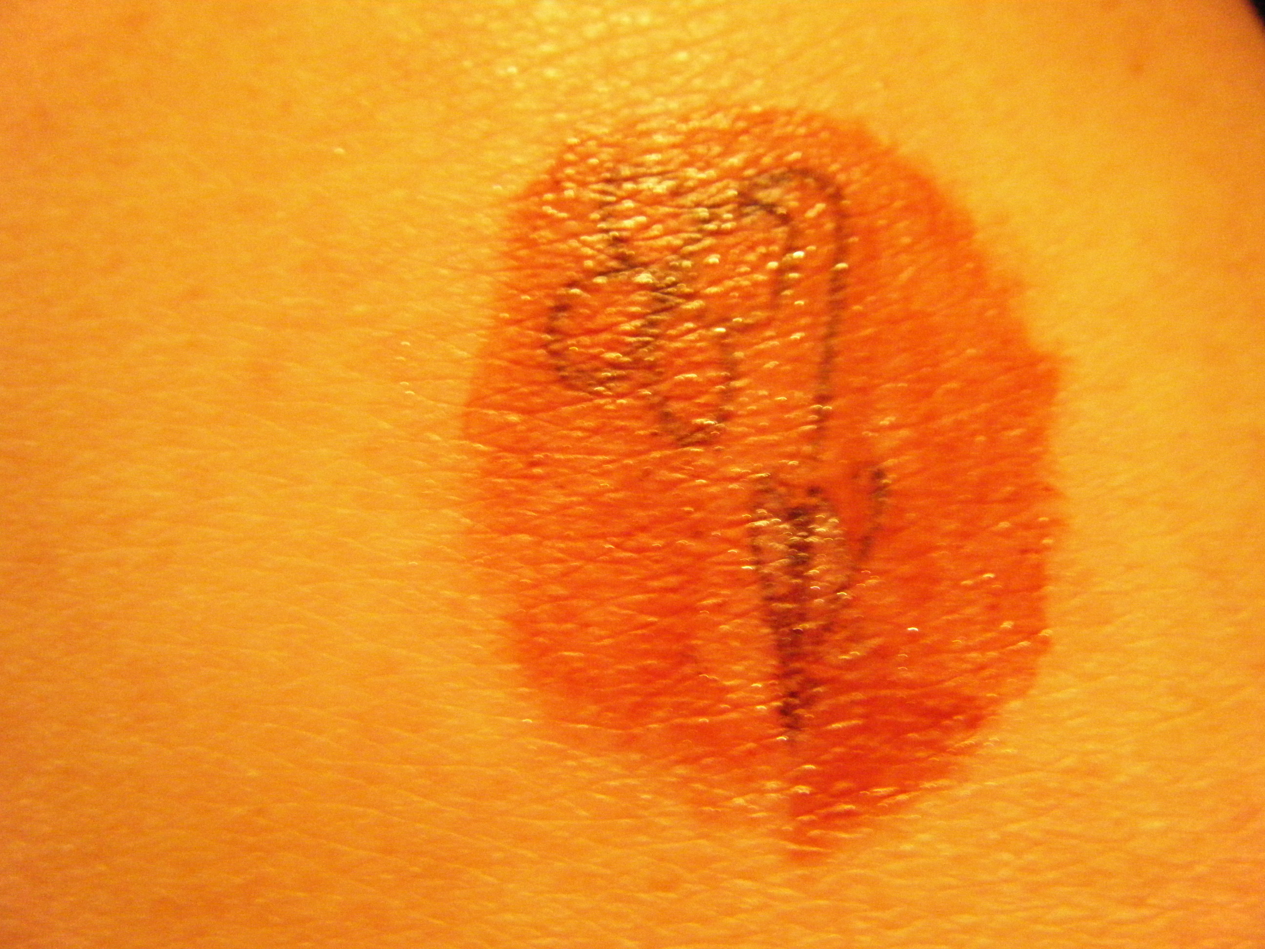 Tattoo Removal Review - Easier